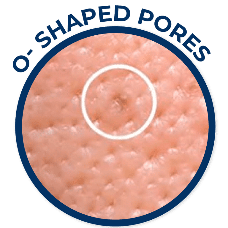 Acne Scar, Scar & Pore Ko Skin Specialist