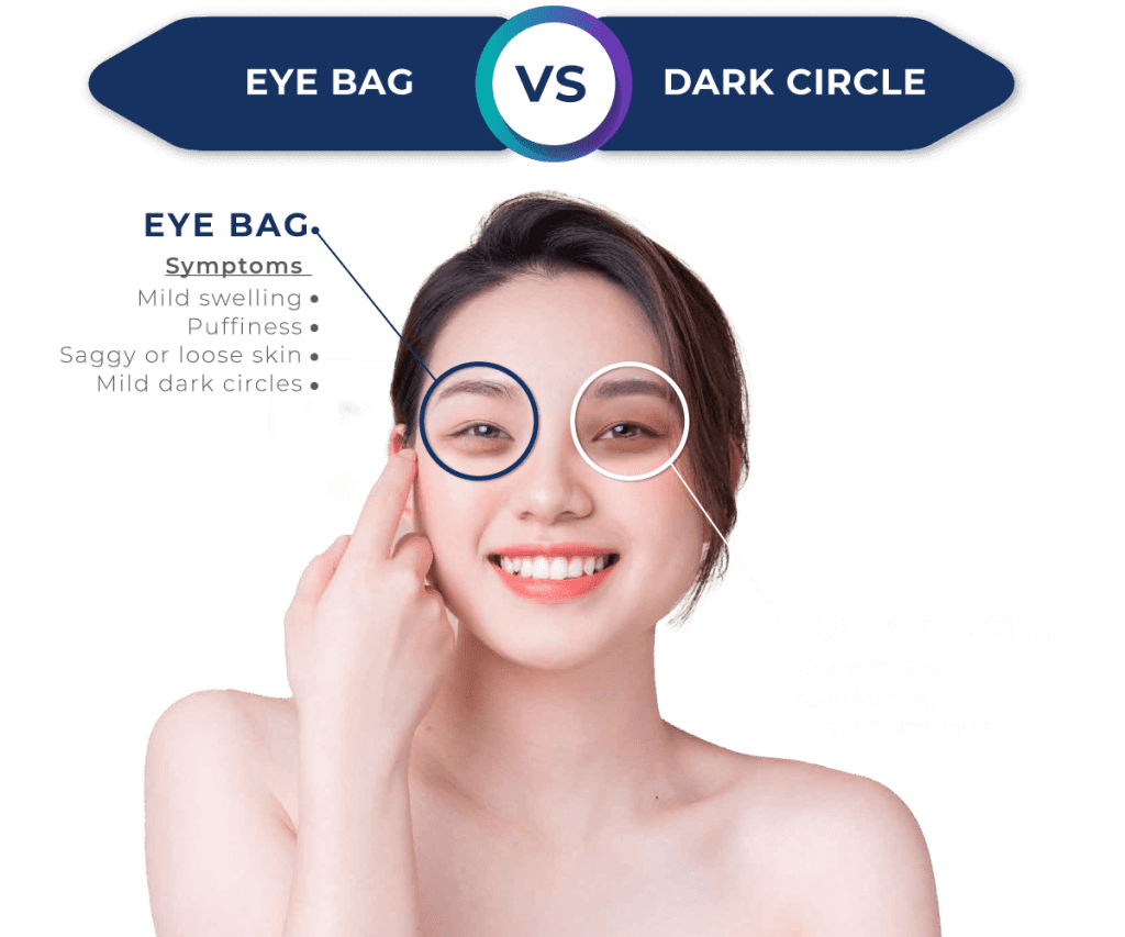 Dark Circle & Eye Bag Ko Skin Specialist