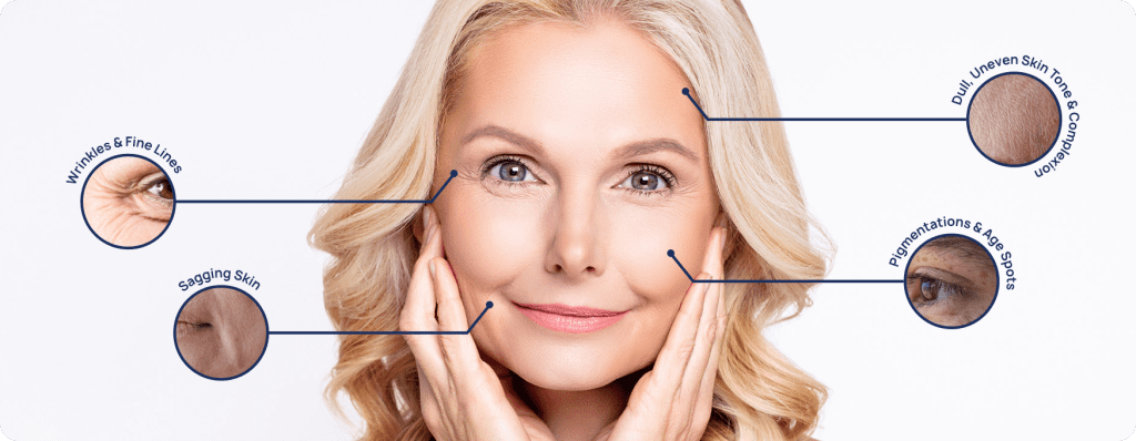 Signs of Skin Aging