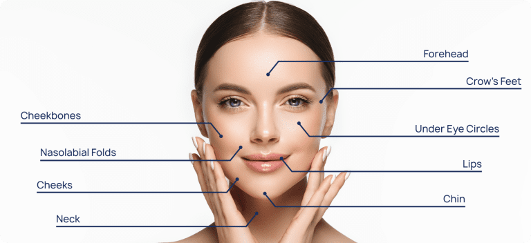dermal filler areas for injections