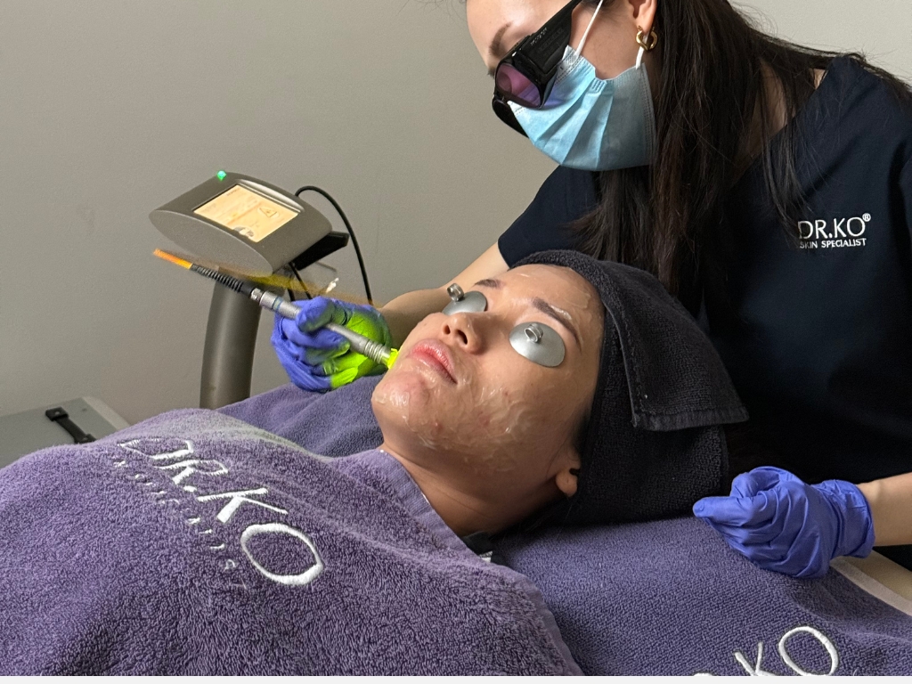 a customer is undergoing dual yellow laser at dr ko skin specialist