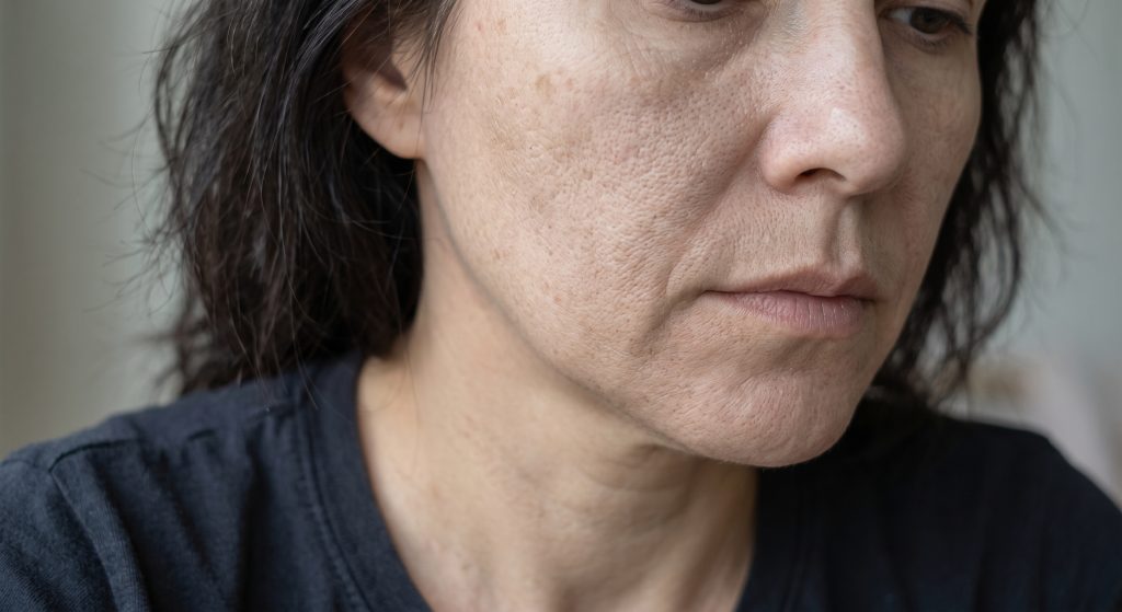 Close-up of dull skin with uneven texture and visible pores